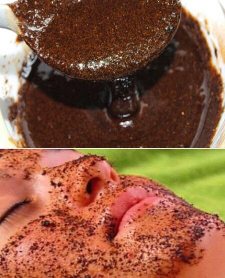 Pilling mask with a coffee beam